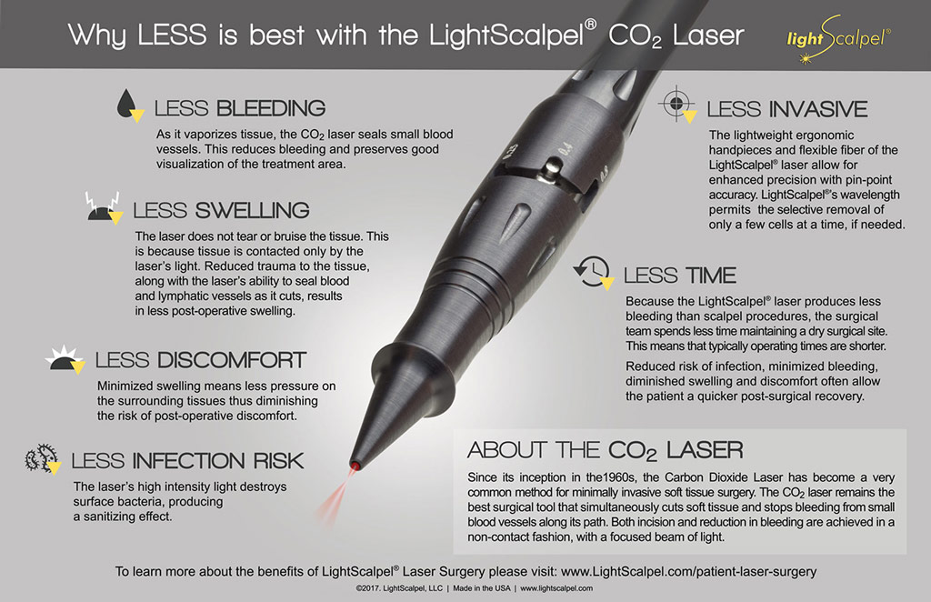 LightScalpel CO2 Laser infographic